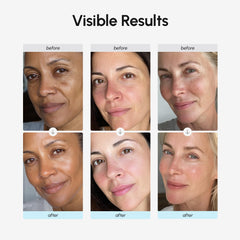 MAREE Crema facial ingredientes retinol hialuronico: fórmula destacada.