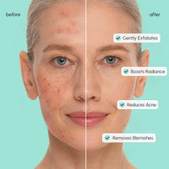 MAREE Pads tono equilibrante: refina poros y aporta balance diario.