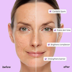 MAREE suero despigmentante para manchas faciales, uso diario.