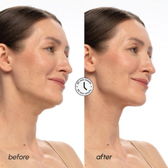 MAREE V Line Masque Hydratation Acide Hyaluronique nourrit et assainit la peau du cou.