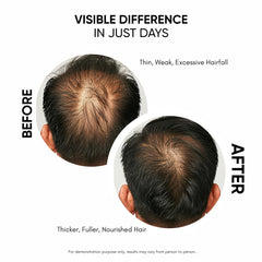 Masofta Serum fortalecimiento del cabello para menos quiebre