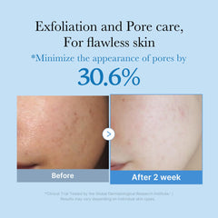 aplicación diaria de medicube Zero Pore Toner para poros más finos.