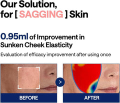 Mediheal Pads de Tónico con Colágeno: aplicación concentrada en el área de ojos.