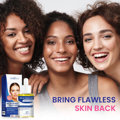 MEOLY Milia Remover, zonas sensibles como ojos y mejillas, uso diario.
