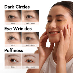 Parches oculares MIZON con mucina de caracol para nutrición profunda.