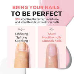 Modelones: uñas dañadas cubiertas, apariencia más uniforme y saludable.