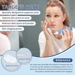 Mopayzer azelaic acid cream texture close-up shows a light, fast-absorbing formula