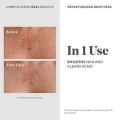 Aplicación de Murad discos exfoliantes en brazo para suavizar la piel