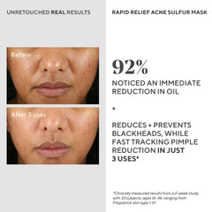 Mascarilla Murad secándose en la piel durante 10-15 minutos.