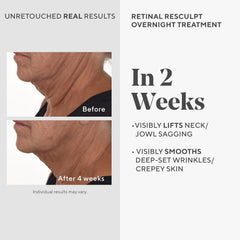 Murad Retinal ReSculpt: textura sedosa del serum para rostro y cuello.