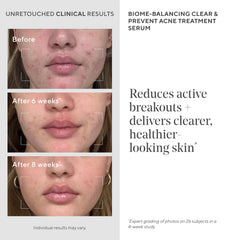 Murad Biome-Balancing Serum : acide mandélique lissant le teint