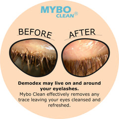Myboclean gel nettoyant paupières et cils, hydratant et purifiant