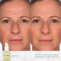 NassifMD Hydro-Screen Serum, aplicación matutina para piel luminosa.