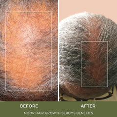 NOOR HAIR Wonder Growth Spray: massage doux stimule les racines et peut favoriser la circulation.