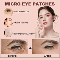 Aplicación suave de NOVALIFT Micro Eye Patches en el contorno de ojos.