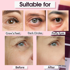 Nuckhuce Calcium Multi Balm Stick para ojos: firmeza y confort inmediato.
