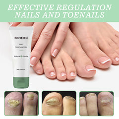 Nutraboost Nail Extracto Arbol Te, aroma suave y aroma calmante al aplicar