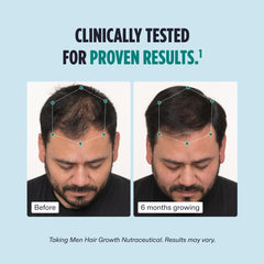 Dúo de acción para fortalecer el cabello desde la raíz.