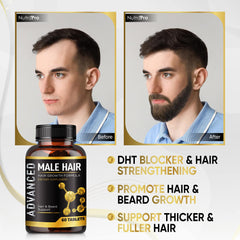NutraPro Crecimiento Capilar, enfoque en la línea del cabello, densidad potencial.