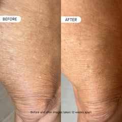 hidratación corporal rápida de oneskin BODY OS-01 calma la piel