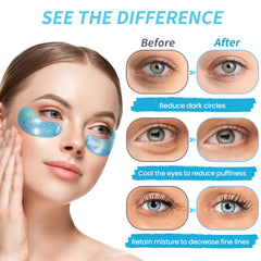 Onespring parches ojos reducen hinchazón y ojeras para despertar la mirada