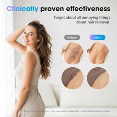 Oreeth IPL, enfriamiento a 7°C para sesiones más suaves.