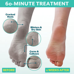 Patchology PoshPeel Pedi Cure, botas exfoliantes en acción para suavizar la piel de los pies