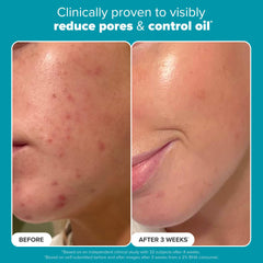 Paula's Choice Skin Perfecting 2% BHA, aplicación en mano para poros visiblemente limpios.