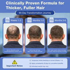 Pdam Minoxidil spray de aplicación fácil para cabello debilitado