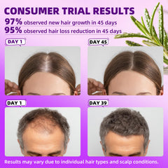 Pipuxi Minoxidil spray dosificador para aplicación precisa