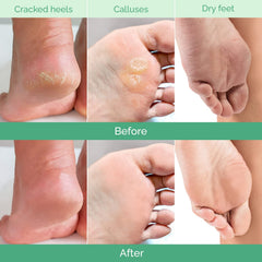 PLANTIFIQUE application masque pieds – étape rapide pour soin maison