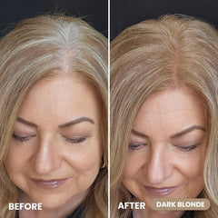 Prime Prometics cubre raíces crecidas de forma suave y natural.