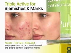 Purito serum gotero, aplicación suave para imperfecciones