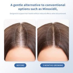 Aplicador de precisión de QGGQ para entrega localizada en cabello.