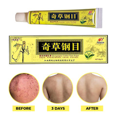 Application de la crème QICAOGANGMU sur une zone irritée.