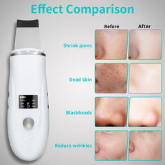 QYCSL espátula facial con base de carga dual para uso cómodo