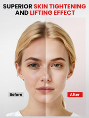 Thérapie lumineuse rouge sur le visage, stimulation du teint possible.