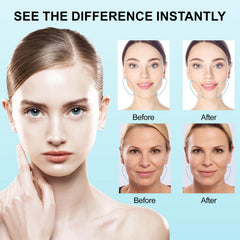 Redcool cinta de levantamiento facial para ojos y mandíbula con adherencia estable