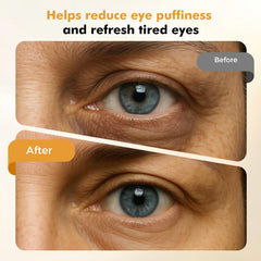 Enfriamiento con luz azul de REDLOOK para reducir la hinchazón alrededor de los ojos.