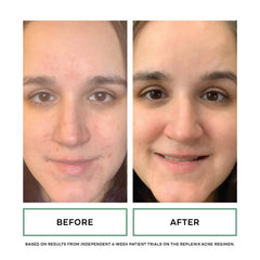 Replenix aplicación en manos para limpieza suave del rostro.