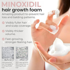 Minoxidil de Rida Hair: cabello con mayor densidad y volumen