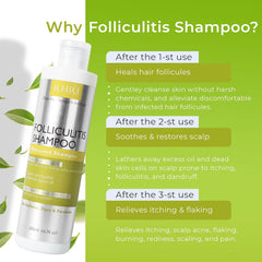 Espuma suave de Rida Hair Foliculitis Shampoo durante el lavado.