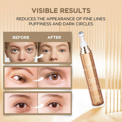 RONKIE ojos-finas-lineas reducidas: efecto suave para suavizar arrugas en el contorno.