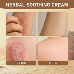 Rulinal crema hierbas: nutrición profunda para piel áspera.