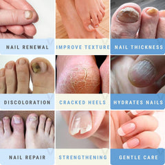 Scientific Solutions Global Urea 50 Nail Gel: cuidado de pies y uñas