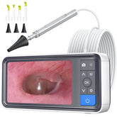 ScopeAround otoscope avec écran IPS – visualisation claire lors d’un examen