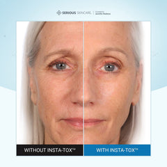 Serious Skincare Insta-Tox aplicación rápida: resultados visibles en minutos.