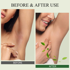SHVYOG desintoxicante para axilas, exfoliante fino que cuida la piel.