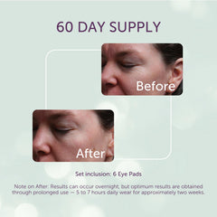 Patchs yeux Silc Skin – hypoallergenique évite les irritations autour des yeux.