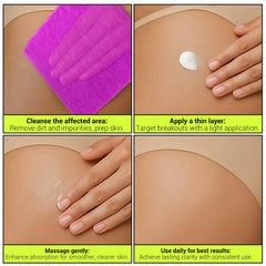 SKINBOSS tratamiento acne espalda-pecho: cuidado de zonas difíciles